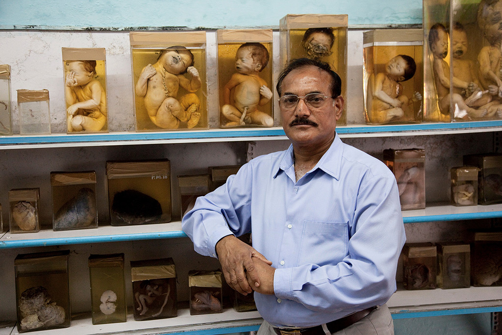 Bhopal doctor with fetuses